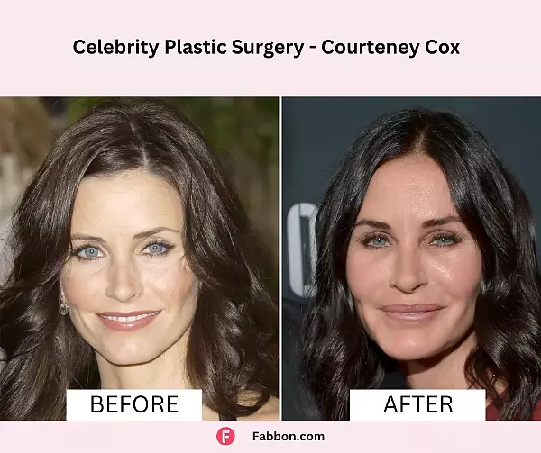 medium-courtney-cox-celebrity-plastic-surgery-1700468193.png