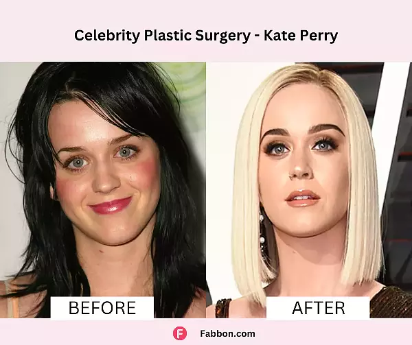 medium-katy-perry-celebrity-plastic-surgery-1700468268.png