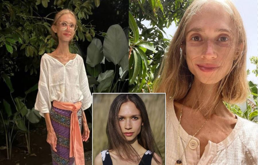 27 წლის  გოგონა, რომელიც მხოლოდ ხილით იკვებებოდა, კუნძულ ბალიზე გარდაცვლილი ნახეს - ქა­ლის ცხე­და­რი მხო­ლოდ 23 კი­ლოგ­რამს იწო­ნი­და